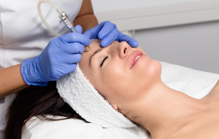 main of Microdermabrasion Can Help People Get the Skin They Desire