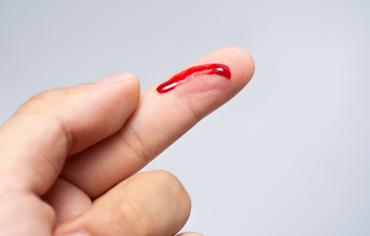 thumbnail of Hemophilia Can Turn a Minor Injury Into a Major Issue